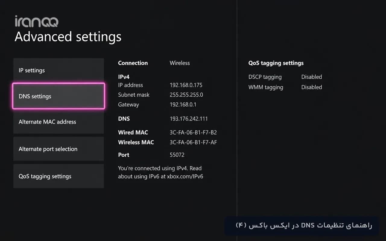 مرحله ۴: وارد DNS settings شوید